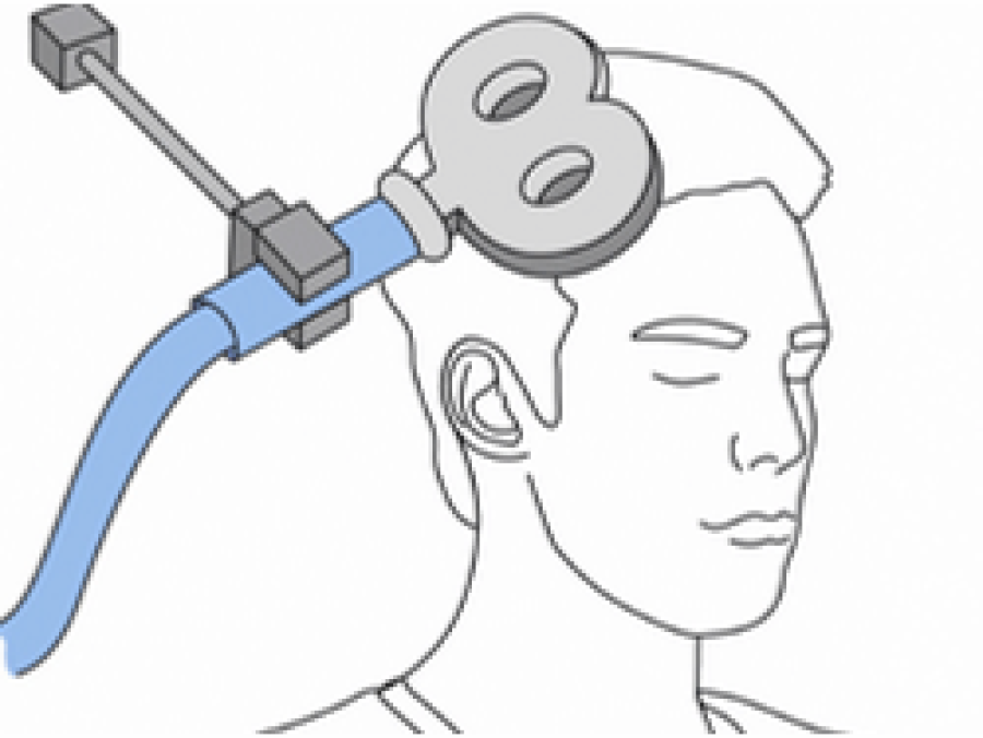 Transkranielle Magnet-Stimulation (TMS) - NeuroPraxis Mannheim